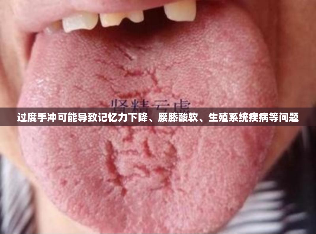 过度手冲可能导致记忆力下降、腰膝酸软、生殖系统疾病等问题