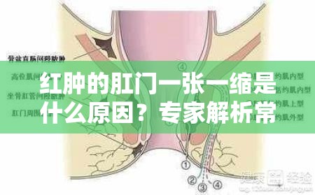 红肿的肛门一张一缩是什么原因？专家解析常见症状与治疗方法